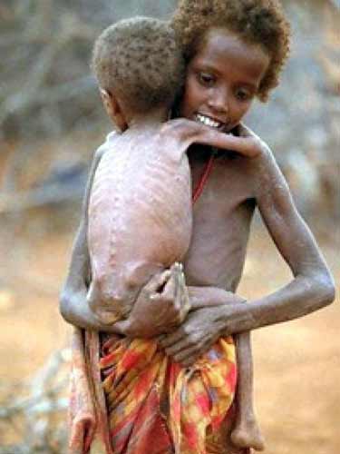 Foamete in Somalia