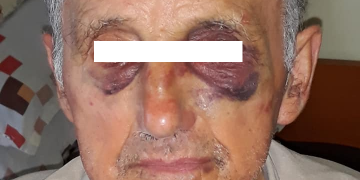 Bătrân din Sighetu Marmației, snopit în bătaie. Ar fi fost agresat la Spitalul din oraș – FOTO