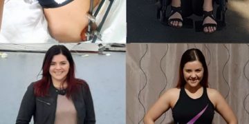 Cum se simte motociclista din Satu Mare, victima unui accident rutier produs anul trecut în Baia Sprie