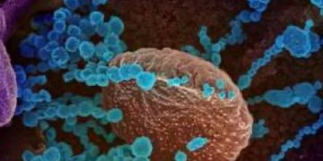 Medic specialist despre Coronavirus SARS-Cov2 și infecția Covid-19. Cum să te ferești de boală