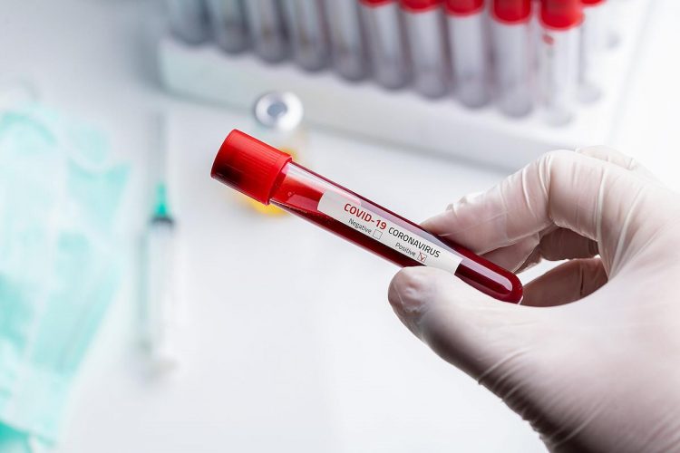 Coronavirus: Numărul infecțiilor a ajuns la 44
