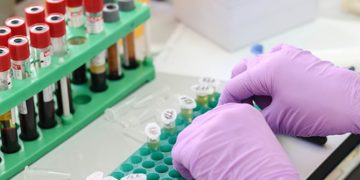 Al 23-lea deces al unei persoane confirmate cu noul coronavirus