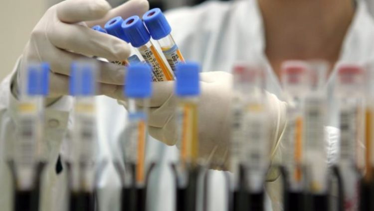 OMS: «Coronavirusul ar putea să nu dispară niciodată. Ar putea deveni endemic la fel ca HIV»