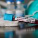 România devine zonă roșie: Testul PCR, OBLIGATORIU pentru toți românii care vor să călătorească în Belgia