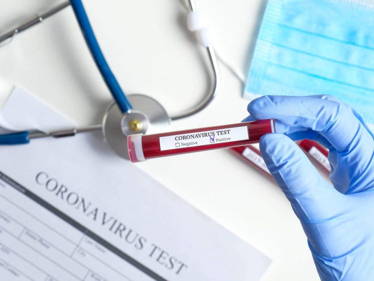 Sume uriaşe plătite pentru testele COVID. Câţi bani au dat românii pe analize care în alte ţări sunt gratuite