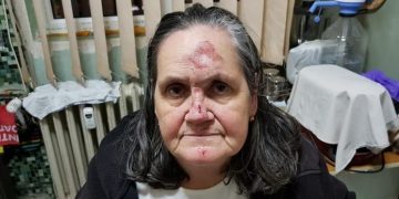 Bătrână în vârstă de 74 de ani, pozitivă la testul COVID, rănită și abandonată în curtea spitalului