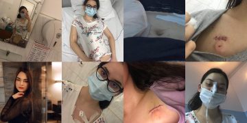 APEL UMANITAR iniţiat de Colegiul Tehnic “George Barițiu” Baia Mare pentru Melisa, o tânără de 20 de ani care are nevoie de sprijin