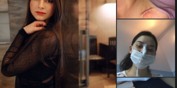 Povestea Melisei, studenta din Baia Mare care a fost diagnosticată cu cancer. Împreună o putem ajuta