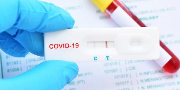 Sorin Câmpeanu, atenționare către DSP: „În unitățile de învățământ fără cabinet medical, nu au de ce să ajungă teste antigen”