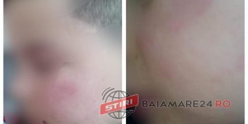 Incident şocant la şcoala din Repedea! Băiețel de 7 ani lovit de tatăl unei colege în timpul orei, sub privirile îngrozite ale învățătoarei – foto