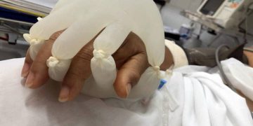 GEST pentru pacienţii grav bolnavi de Covid. „Mâna iubirii”, strategia asistenţilor medicali din Brazilia