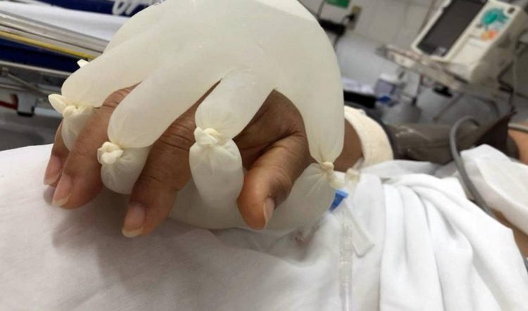 GEST pentru pacienţii grav bolnavi de Covid. „Mâna iubirii”, strategia asistenţilor medicali din Brazilia
