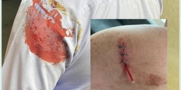 Un polițist lovit cu sapa în zona capului, considerat „vinovat” de procuror