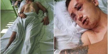 Băiat bătut, dezbrăcat, incendiat și lăsat să moară pe un trotuar