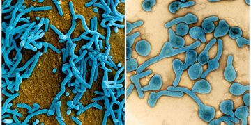 Primul caz de infecţie cu virusul ucigaş Marburg, în vestul Africii