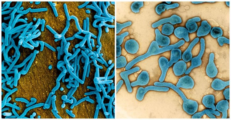 Primul caz de infecţie cu virusul ucigaş Marburg, în vestul Africii