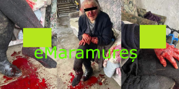 Povestea incredibilă în care o femeie din Săcălășeni a fost sfâșiată de câinele vecinilor. GALERIE FOTO