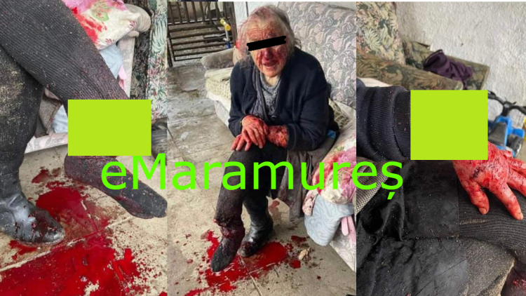Povestea incredibilă în care o femeie din Săcălășeni a fost sfâșiată de câinele vecinilor. GALERIE FOTO