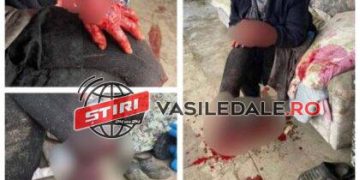 IMAGINI HORROR: FEMEIE SFÂŞIATĂ DE UN CÂINE AMSTAFF LA SĂCĂLĂŞENI