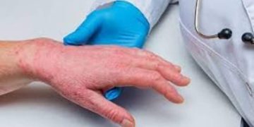 Femeie, lovită în cap cu toporul de nepoata pe care o crescuse