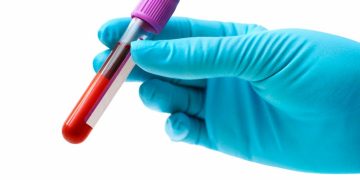 Confuzie. Românul suspectat de variola maimuței are varicelă