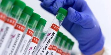 Se răspândeşte! Al doilea caz de variola maimuței diagnosticat în România