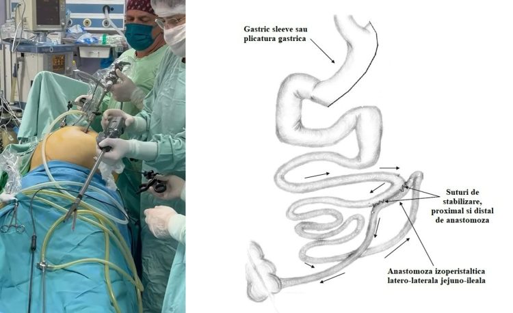 Premieră la Spitalul Județean din Baia Mare