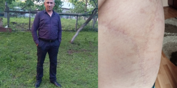 Apel umanitar! Un bărbat din Țara Lăpușului riscă să-și piardă total mobilitatea după 3 operații eșuate și are nevoie de ajutorul nostru