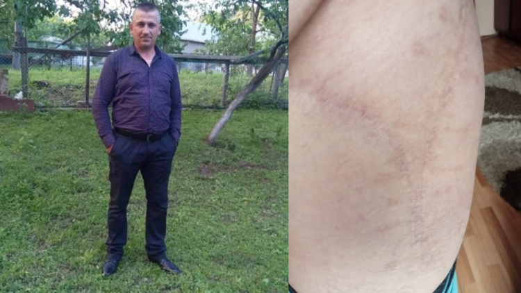 Apel umanitar! Un bărbat din Țara Lăpușului riscă să-și piardă total mobilitatea după 3 operații eșuate și are nevoie de ajutorul nostru