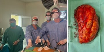 În Spitalul Județean din Baia Mare continuă seria de intervenții minim invazive