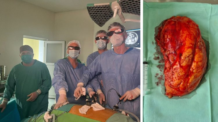 În Spitalul Județean din Baia Mare continuă seria de intervenții minim invazive