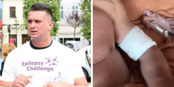 ACTUALIZARE: Mihăiță Sână a fost tăiat de 2 indivizi. Ce spune antreprenorul băimărean despre incident? AUDIO