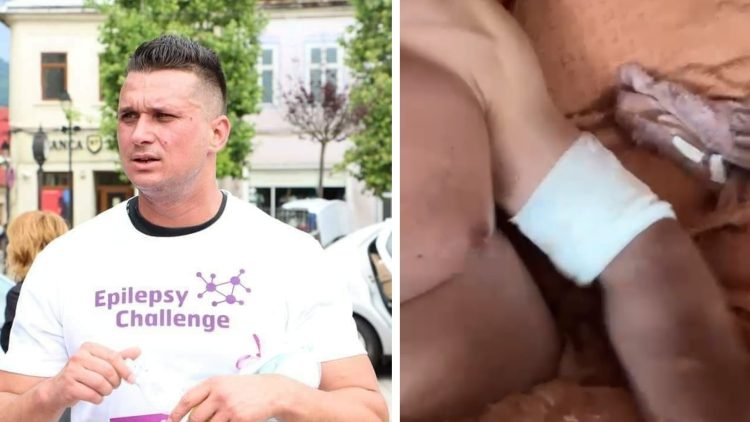 ACTUALIZARE: Mihăiță Sână a fost tăiat de 2 indivizi. Ce spune antreprenorul băimărean despre incident? AUDIO