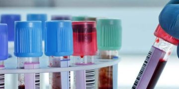 S-au diluat și probele! Asistenta de la SML Maramureș, care îndoia cu apă analizele șoferilor băuți, scapă de condamnare!