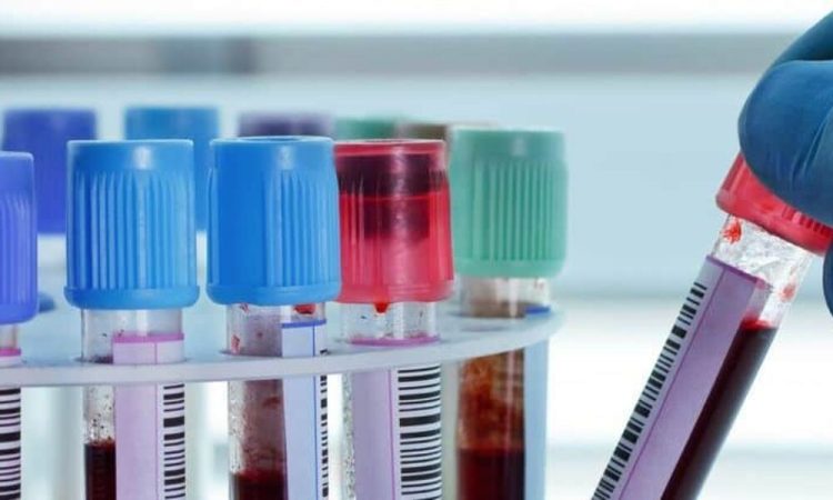 S-au diluat și probele! Asistenta de la SML Maramureș, care îndoia cu apă analizele șoferilor băuți, scapă de condamnare!