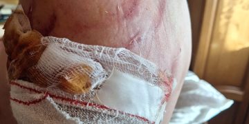 Caz șocant la Târgu Lăpuș: Un fost profesor, atacat de 2 kangali în propria grădină