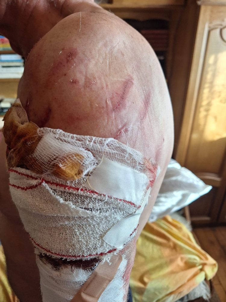 Caz șocant la Târgu Lăpuș: Un fost profesor, atacat de 2 kangali în propria grădină