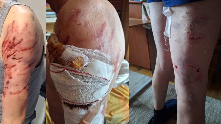 Caz șocant la Târgu Lăpuș: Un fost profesor, atacat de 2 kangali în propria grădină