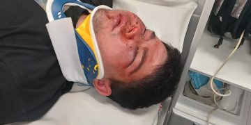 „Fratele meu a fost bătut cu brutalitate de patru indivizi. În ce fel de lume trăim?” – mesajul cutremurător al unei cititoare