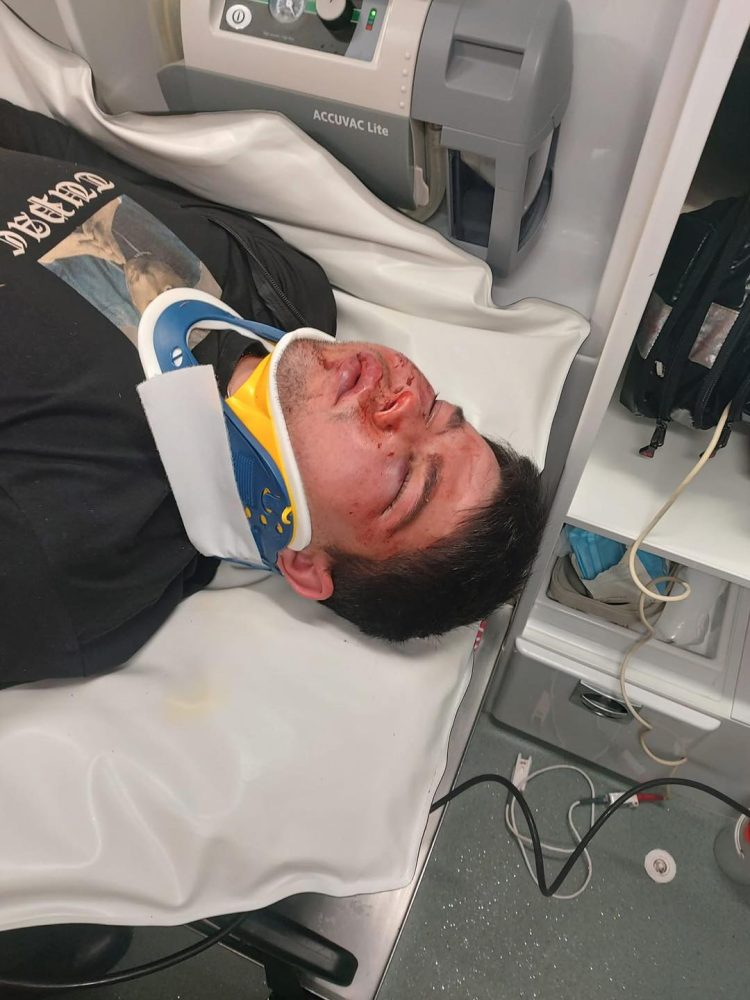 „Fratele meu a fost bătut cu brutalitate de patru indivizi. În ce fel de lume trăim?” – mesajul cutremurător al unei cititoare