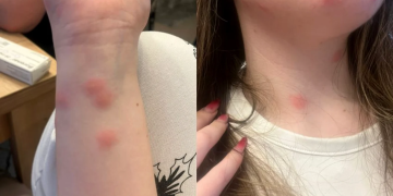 Coșmar pe ruta București–Sighet: o tânără din Maramureș ajunge la spital după o noapte în cușeta CFR. Statul care ne lasă să putrezim pe șine.