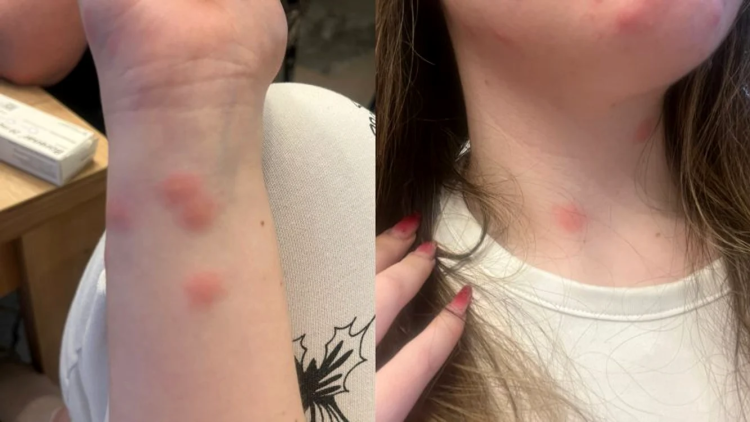 Coșmar pe ruta București–Sighet: o tânără din Maramureș ajunge la spital după o noapte în cușeta CFR. Statul care ne lasă să putrezim pe șine.