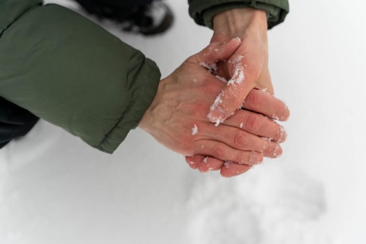 Cum recunoști degerăturile și ce poți să faci dacă te-a afectat gerul