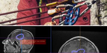 APEL URGENT: Salvatorii trebuie salvați! Salvamontistul Ștefan Geană luptă pentru viață