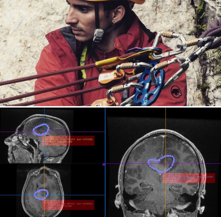 APEL URGENT: Salvatorii trebuie salvați! Salvamontistul Ștefan Geană luptă pentru viață
