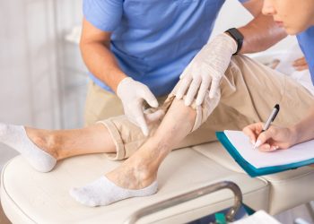 Operația de varice: când este necesară?